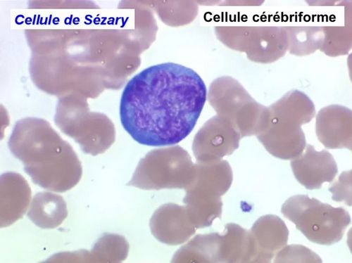 Clomid Fertility